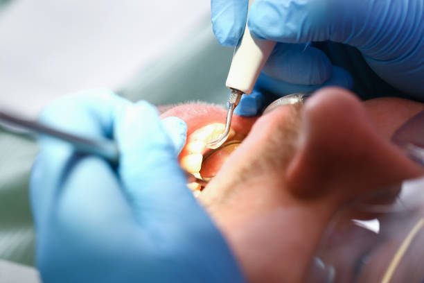Best Urgent Dental Care for Toothache in Gerdine, AL